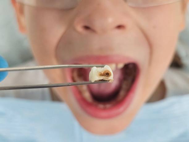 Professional Emergency Dental Service in HI